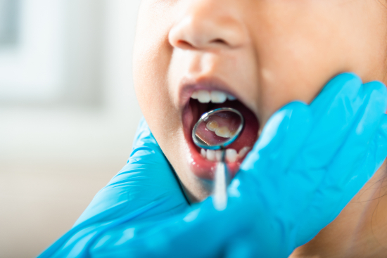 虫歯治療をしている子供