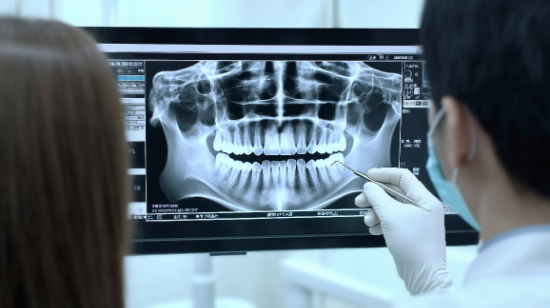 歯周病の治療のためレントゲンを確認する歯科医師